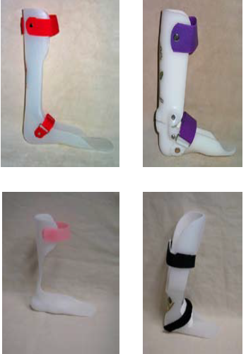 3D Printed AFO